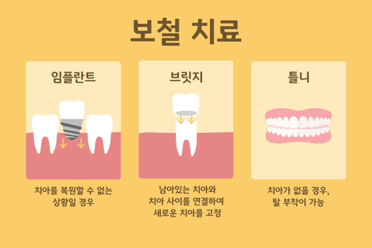  당감동치과 보철치료 건강보험적용 정리