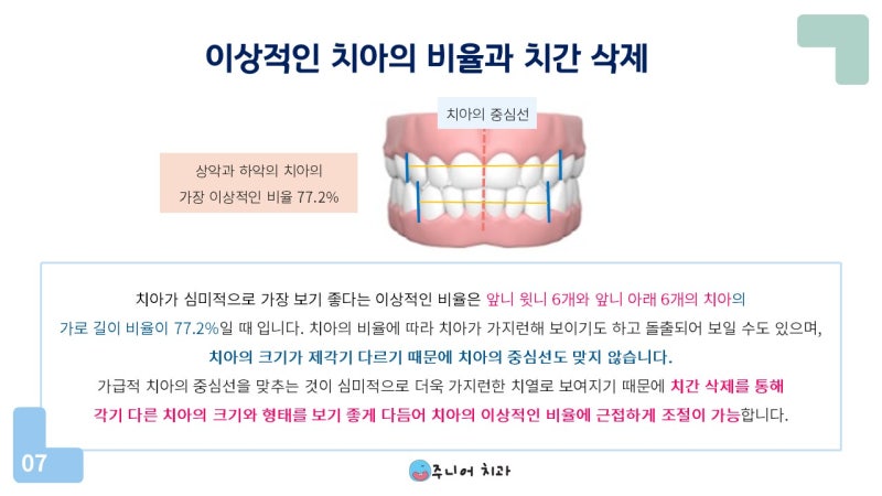 포천교정과는 다양한 교정기기를 보유하고 있어 선택의 폭이 넓습니다. 4