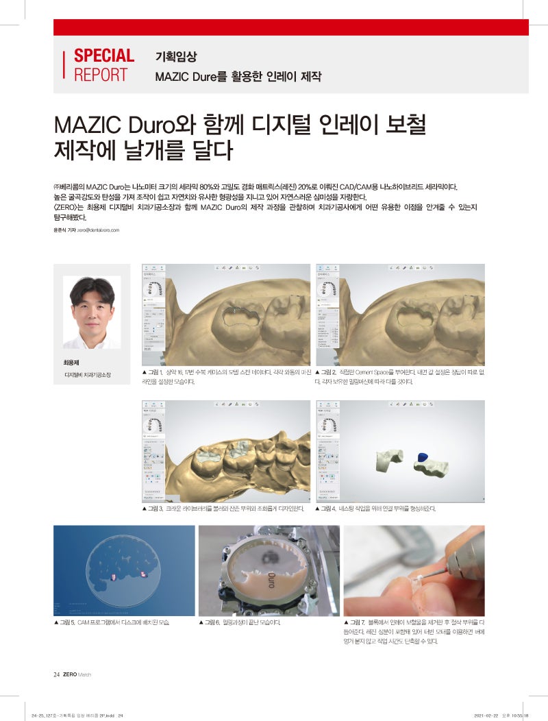 [ZERO 2021.3월호 기획특집 임상] MAZIC Duro와 함께 디지털 인레이 보철 제작에 날개를 달다 : 네이버 블로그