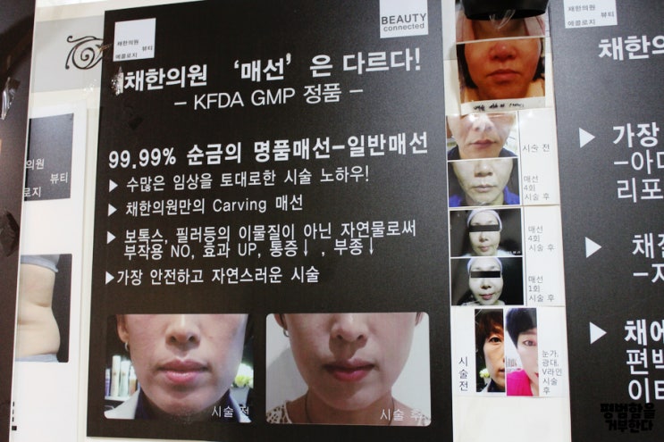  안산매선 채한의원 매선의 달인을 만나다.
