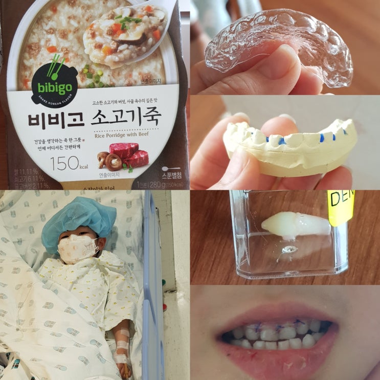  삶이 드라마/노트북, 과잉치아 수술, 인연