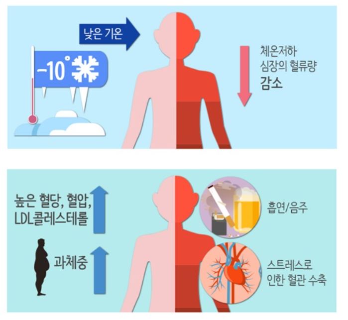  항상 손 발이 차가워요 / 수족냉증 원인,  도움되는 생강 계피차 양파 부추 옻