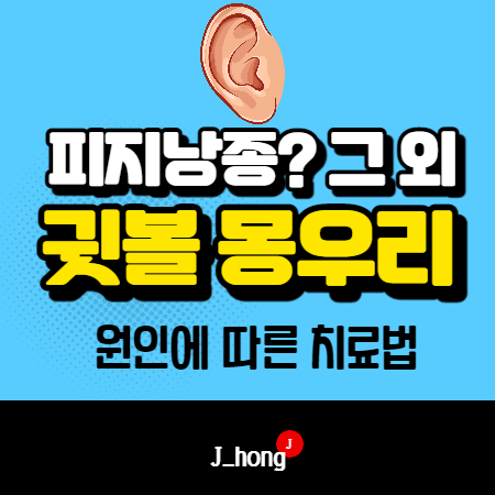  귓볼 몽우리가 잡히시나요? 원인, 치료! - 귓볼 염증, 귀 피지낭종