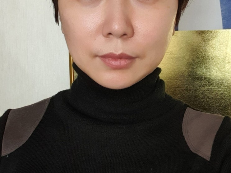  청담 튠페이스 시술 받은 후기