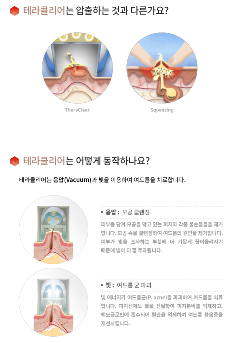 피부과 여드름 압출 스케일링 염증주사 8