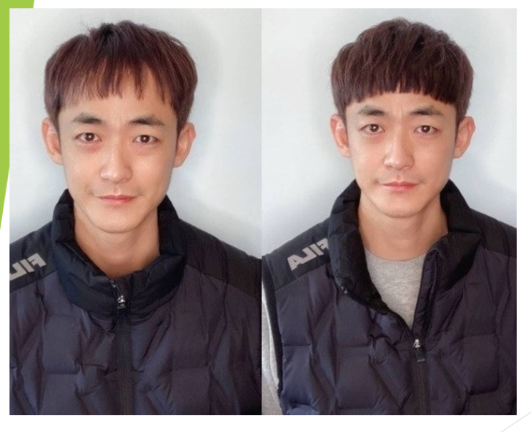  증모술 통해 회춘한 한민관