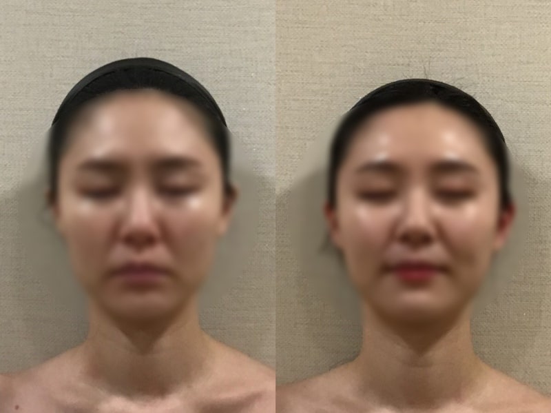판교 경락마사지 얼굴라인 정돈 2