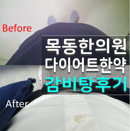 목동한의원 감비탕으로 뱃살 삭제 성공