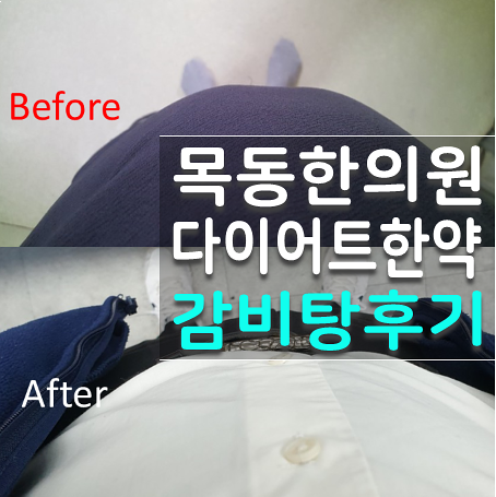  목동한의원 감비탕으로 뱃살 삭제 성공
