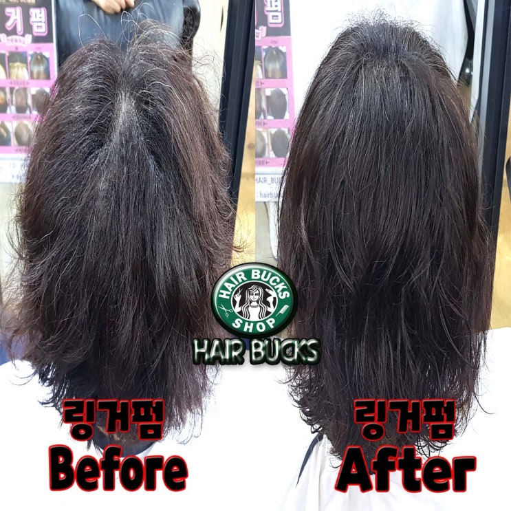  어머님들 ! 펌하실땐 링거펌은 필수입니다 !!