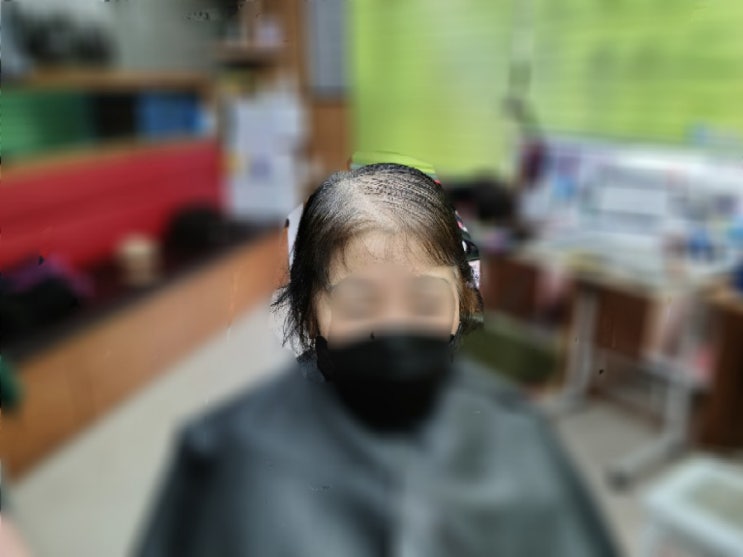  헌집줄께 새집다오~ 보톡스증모 교체시기는? 춘천김호증모가발 가발덕후 은주누나