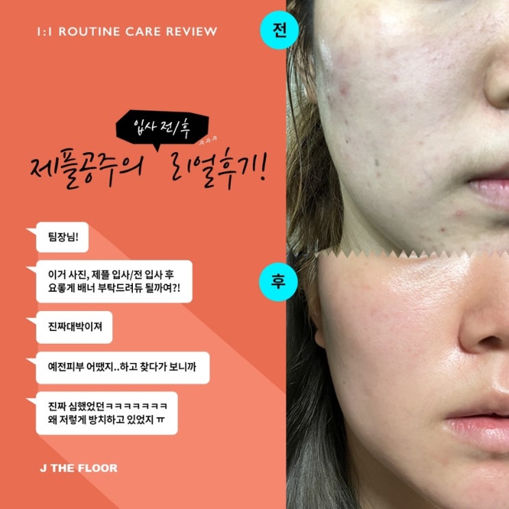  물풍선키트 ! 수분 그자체 ️ 주문폭주 ️브루노바사리 아쿠아키트 브루노바사리 수분키트