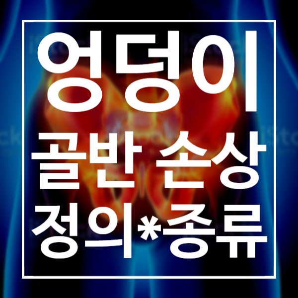  엉덩이 골반 손상 5가지