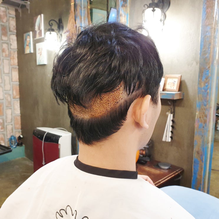  남자 증모술 커버 쉽게 채워요