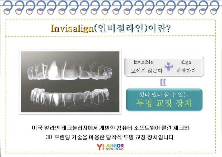  [용인쥬니어치과]인비절라인 교정 전,후 중간체크 -2-