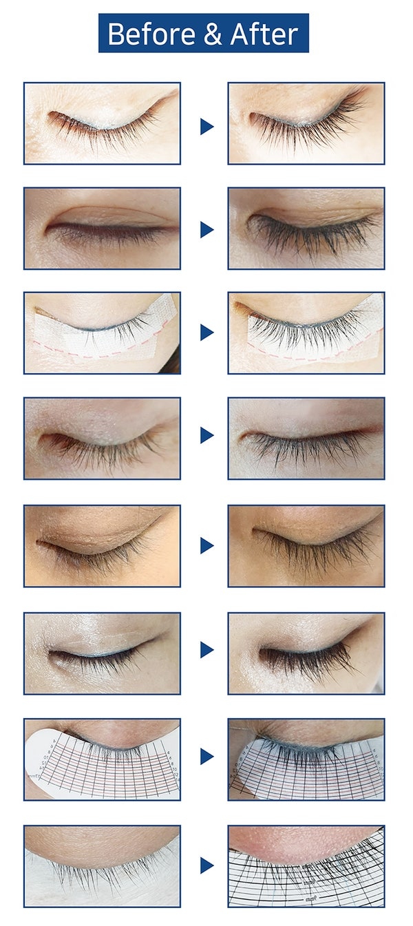 에보케어 래쉬매니지먼트 박스 (전후)