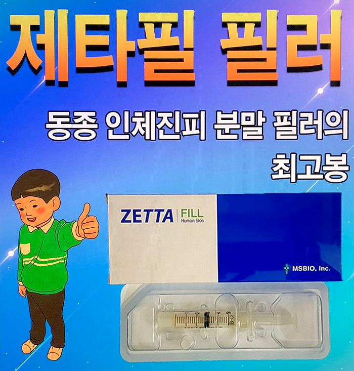 남성필러인 제타필의 장. 단점