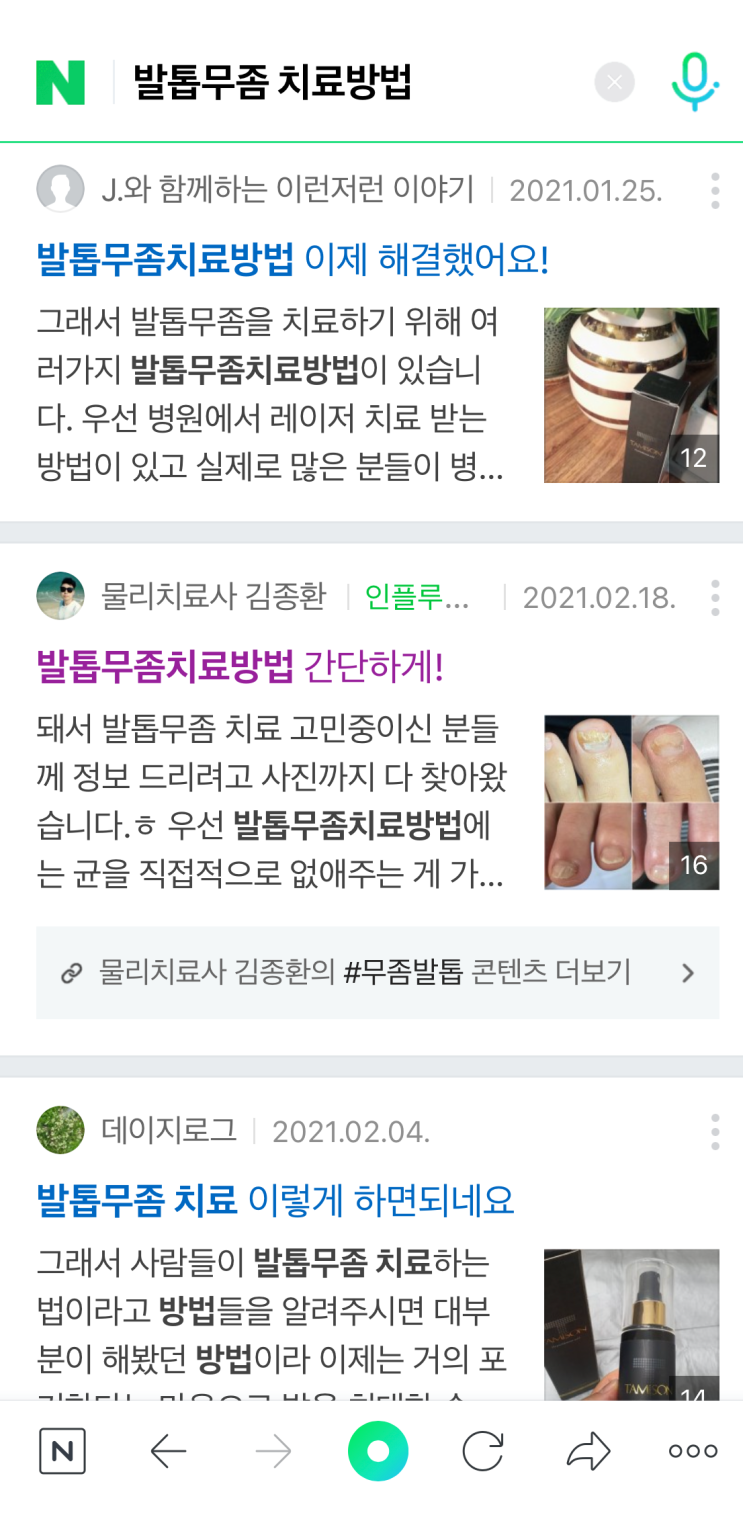  발톱무좀, 마유크림으로 효과 본 후기 feat. 발톱무좀 치료방법