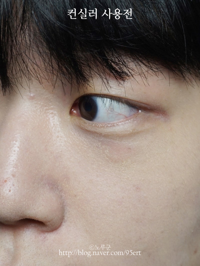 남자 컨실러 추천, 비레디 컨실러 커버력 좋은데? : 네이버 블로그 남자 컨실러 추천, 비레디 컨실러 커버력 좋은데? : 네이버 블로그
