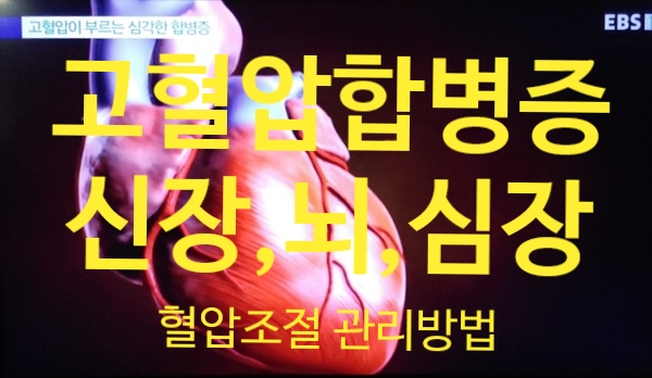  고혈압이 부르는 심각한 합병증-신장, 심혈관, 뇌혈관, 망막, 다리혈관 등 3편 (출처 ebs 명의)