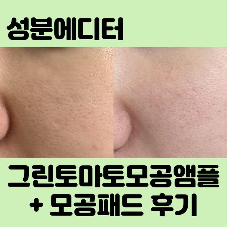  특허받은 성분에디터 그린토마토모공패드 + 앰플세트로 모공관리하세요!
