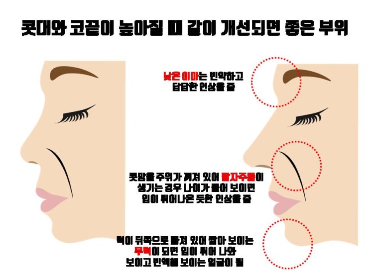  코수술과 같이 하면 코라인 결과 돋보이게 해 주는 수술 Top 3