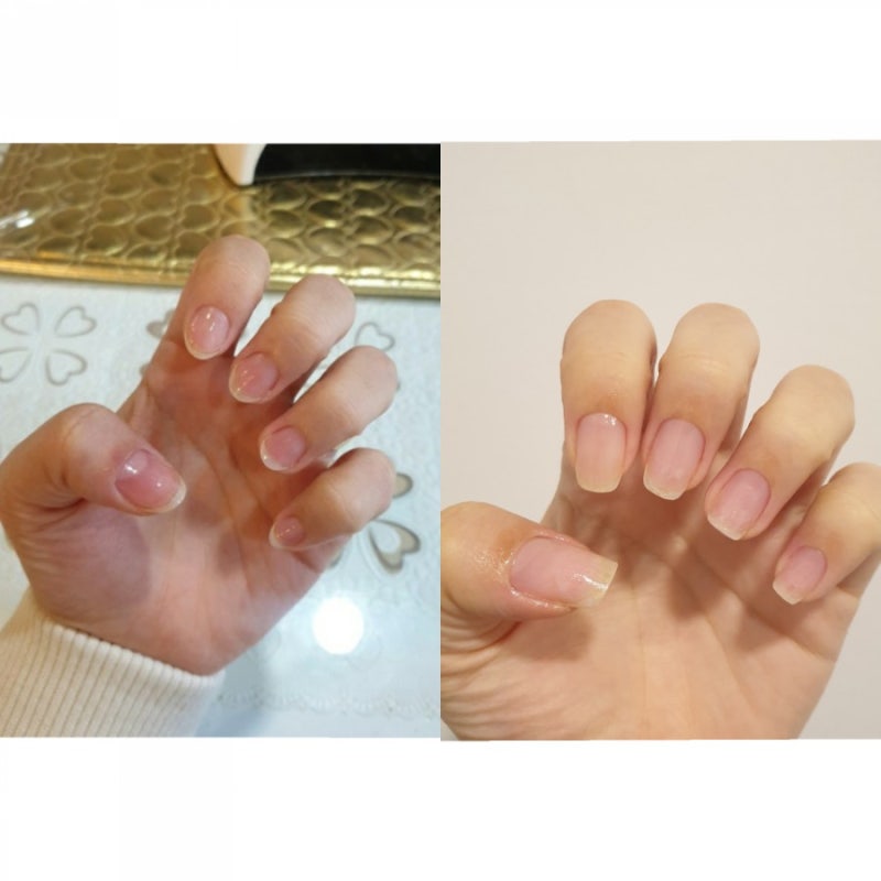 손톱바디 기르기, 물어뜯는손톱 관리 1년 후기+네일쉐입추천 : 네이버 블로그 손톱바디 기르기, 물어뜯는손톱 관리 1년 후기+네일쉐입추천 : 네이버 블로그