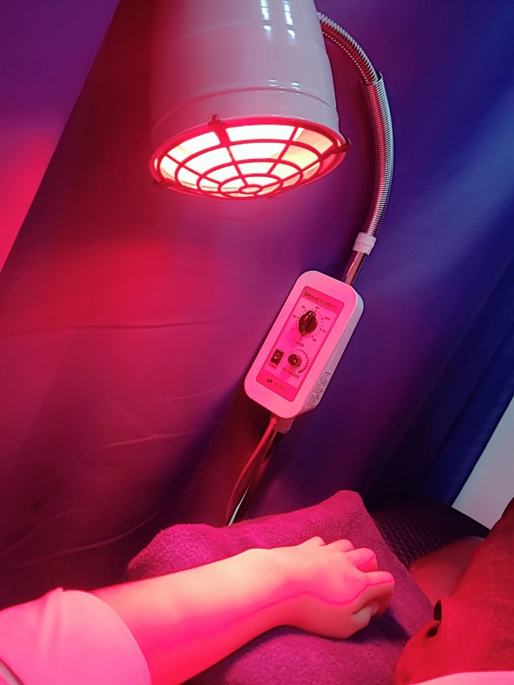  손목통증, 손목삐끗, 손목인대, 체외충격파 후기, 더정형외과의원, 손목터널증후군은 아님!