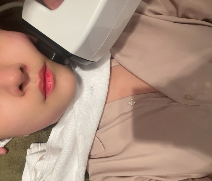  인모드리프팅 3단계 + 재생레이저10일차 솔직후기 :)