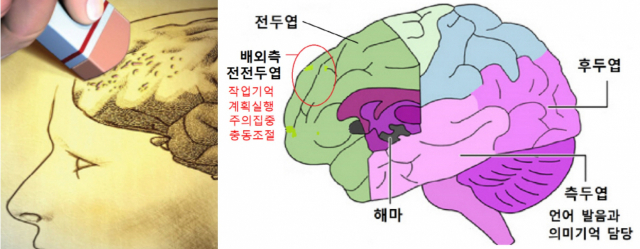 경도인지장애 노인도 주3회 운동하면 치매 늦출수 있다