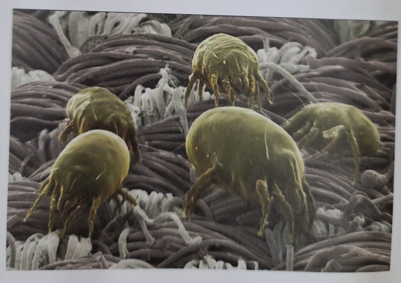 아토피, 건선, 한포진등 자가면역질환 3