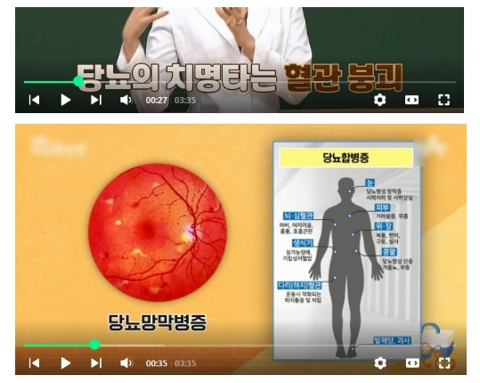  당뇨발, 당수치, 당뇨초기증상 및 당뇨합병증