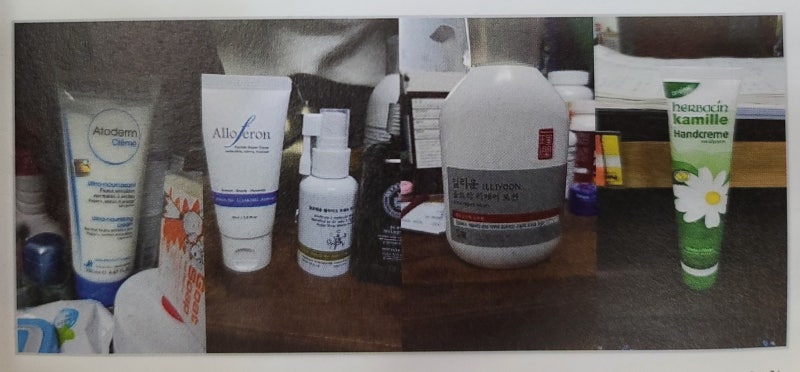 아토피, 건선, 한포진등 자가면역질환 2