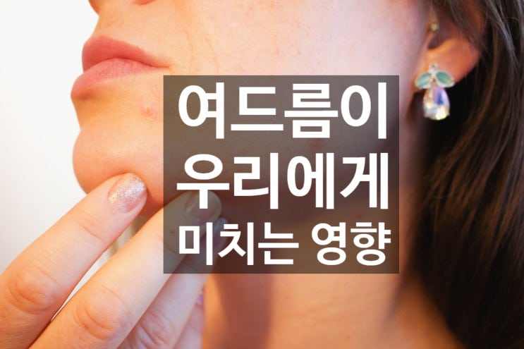  코스멜란 관리 노하우 (5편) - 피부 트러블(여드름) 관리