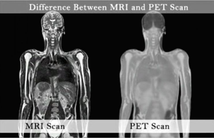  PET-CT 검사하고 왔어요.