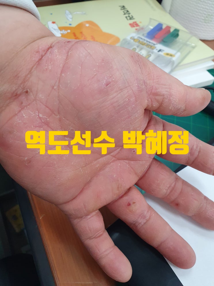 <b>역도</b> 요정 <b>박혜정</b>, 포스트 장미란