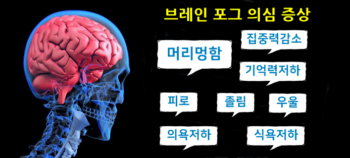 브레인포그 증상, 과다 수면 상태에