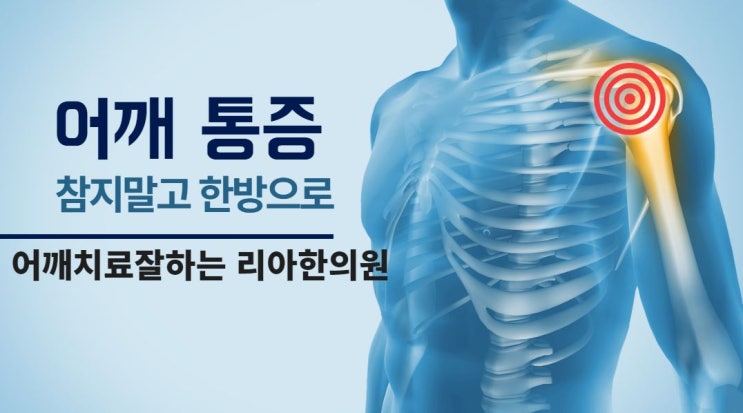  청라통증치료 어깨통증잘보는곳 찾는다면