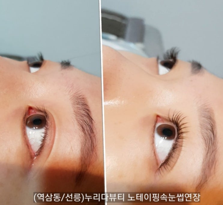  [선릉 속눈썹연장]역삼동 노테이핑&노아이패치 속눈썹연장!! 다크브라운 시술!