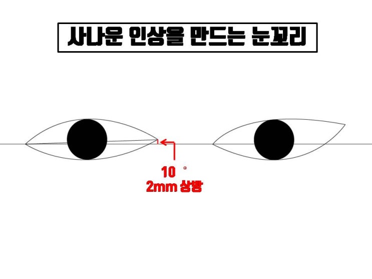  눈매교정과 뒤트임, 밑트임으로 사나운 눈매가 개선되는 이유는?