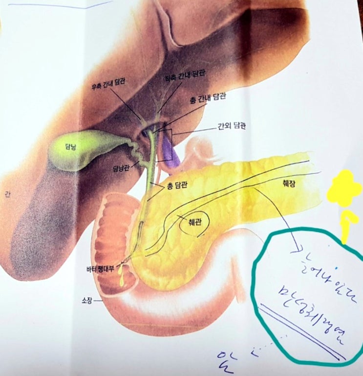  [췌장암 이겨냅시다!]  췌장암 증상으로 소화가 안되고, 등, 옆구리 통증을 느끼셨습니다.