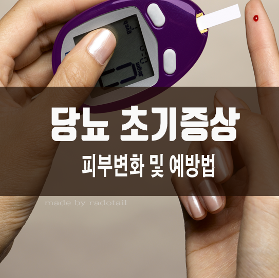 당뇨 초기증상 피부변화와 당뇨병 예방법 : 네이버 블로그
