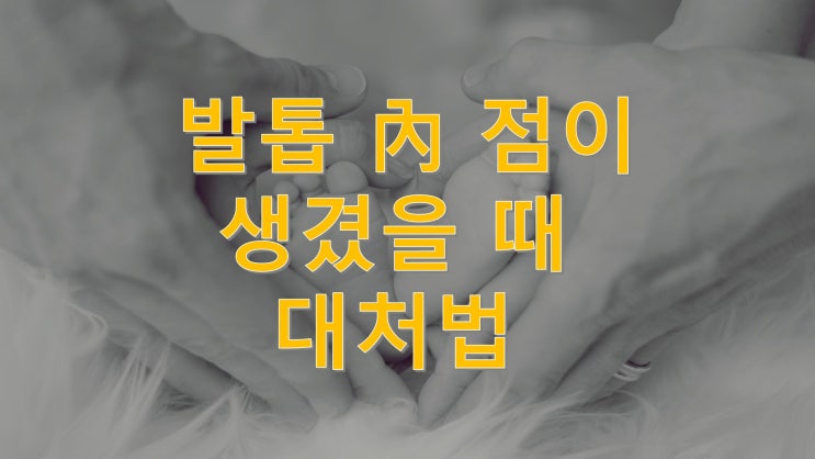  발톱 점 (이물질) 생겼을 때 대처법