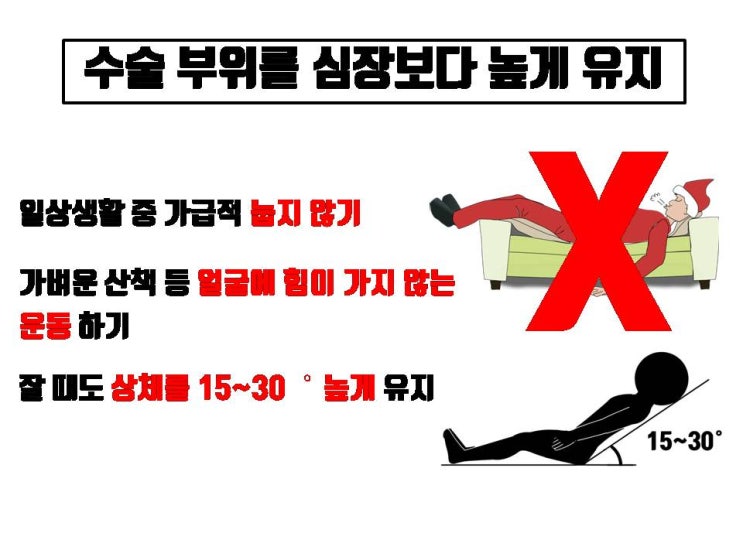  쌍수 붓기 빼기 위한 검증된 방법은 이 세 가지뿐!!! 약사가 권하는 붓기 3종 세트는 한약제로 된 진통소염제에 불과해요