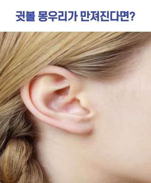  귓볼 몽우리가 만져진다면?