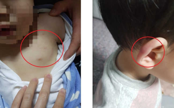 “아직 말도 못하는 어린 아이라서…” 속타는 피해 아동 엄마들 “아직 말도 못하는 어린 아이라서…” 속타는 피해 아동 엄마들