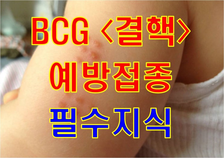 예방접종 필수지식 - BCG(결핵) 예방접종