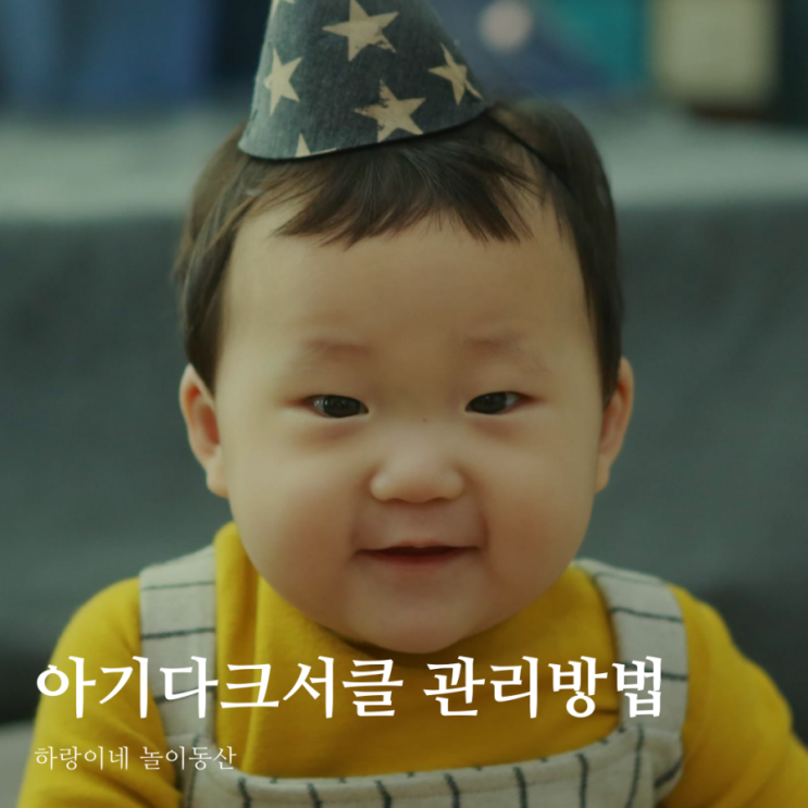  아기 눈밑 다크써클 원인과 유아 다크서클 관리방법