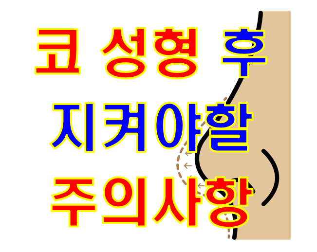  코 성형수술 받은 24살 대학생 - 코 성형 후 지켜야할 주의사항은 어떤게 있나요?