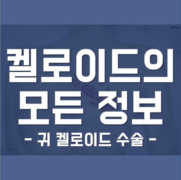  켈로이드의 모든 정보! '피어싱 살튀로 귀 켈로이드 수술?'